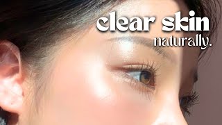 How I Cleared My Skin In 8 Weeks naturally [upl. by Sello522]