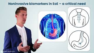 Eosinophilic Esophagitis EoE  Differentiating Patients with Bloodbased Collagen Biomarkers [upl. by Etnod]