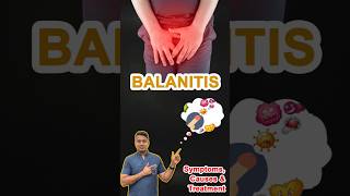 BALANITIS  पुरुष गुप्तांगो पर सूजन खुजली दर्द रेडनेस का Treatment  Dr Venkatesh Kumar noida [upl. by Medarda]