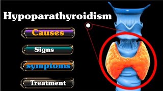 Hypoparathyroidism  Causes  Symptoms  Diagnosis  Treatment ll in Hindi endocrinesystem [upl. by Neilson]