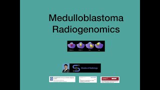 Medulloblastoma Radiogenomics Simplified [upl. by Mickelson]