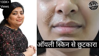 My 1 Month Experience with Glyco 6 Cream  Honest Review in Hindi Personal Experience [upl. by Ettedo]