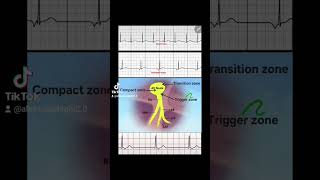 Junctional Rhythms made easy [upl. by Intosh]