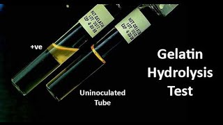 Gelatin Hydrolysis A Biochemical Test for Identification of Gelatinase Enzyme Producing Bacteria [upl. by Aubrette]