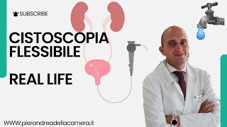 REAL LIFE CISTOSCOPIA FLESSIBILE [upl. by Aisnetroh]