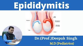 Epididymitis  Inflammation in epididymis  Deepak PD Singh [upl. by Ynatsed]