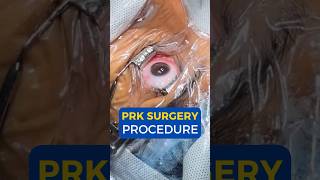 What is PRK Surgery I PRK Surgery Procedure [upl. by Severn]