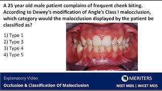 NEET MDS  INICET  Occlusion amp Classification Of Malocclusion  Explanatory Video  MERITERS [upl. by Larina439]