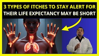 3 TYPES OF ITCHES TO STAY ALERT FOR  THEIR LIFE EXPECTANCY MAY BE SHORT [upl. by Pippa]