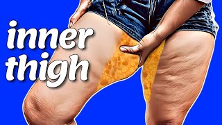 INNER THIGH  LOSE INNER THIGH FAT IN 2 WEEKS [upl. by Anawik]