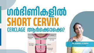 Short cervix പ്രശ്നമോ Cerclage എപ്പോൾ വേണം  DRSUSAN JOSEPH [upl. by Estrella]