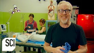 Can a Patients Fart Ignite During Laser Surgery  MythBusters Jr [upl. by Lisabeth859]