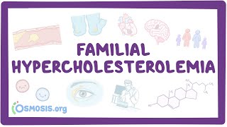 Familial hypercholesterolemia  causes symptoms diagnosis treatment pathology [upl. by Miarfe621]