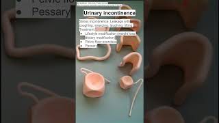 Urinary incontinence [upl. by Parshall474]