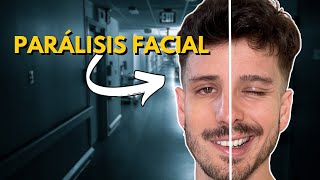 Qué Hacer si Tienes PARÁLISIS FACIAL  Tratamiento y Consejos [upl. by Matrona468]