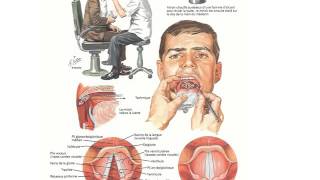 ORL DIAGNOSTIC D’UNE DYSPHONIE [upl. by Perkin]