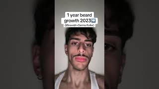 1 year beard growth journey minoxidil beard transformation shorts [upl. by Edobalo261]