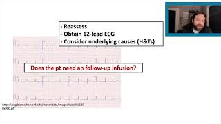 Managing Ventricular Tachycardia  Case Breakdown with Dean Stockley [upl. by Maxie]