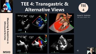 TEE 4 Transgastric amp Alternative Views [upl. by Netsrijk]