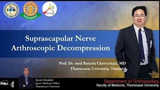 Suprascapular Nerve DecompressionRelease DrQariahMaulidiah ProfDrBanchaChernchujitศนพบัญชาชื่น [upl. by Lemrahs791]