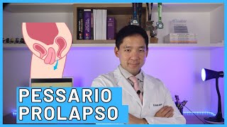 PESSARIO PARA PROLAPSO GENITAL 7 COISAS QUE TODA MULHER DEVE SABER [upl. by Nodarb]