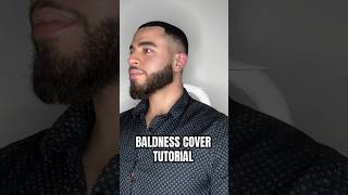 How to cover your baldness  baldness baldnesssolution haircare [upl. by Huoh]