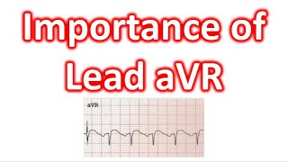 Importance of Lead aVR [upl. by Zulaledairam]