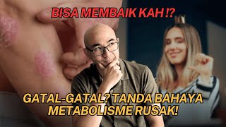 GATAL GATAL  TANDA BAHAYA METABOLISME KALIAN RUSAK [upl. by Culley]