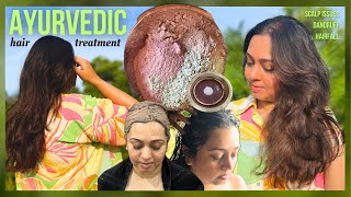 AYURVEDIC Hair Treatment for hairfall amp dandruff  Ayurveda Hair Care results before amp after [upl. by Nagek]