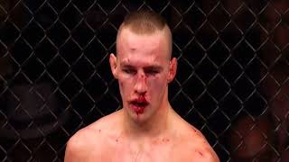 Robbie Lawler vs Rory Macdonald 2  Sweet Dreams [upl. by Oglesby383]