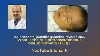 What is the role of transcutaneous bilirubinometry in neonatal jaundice neonataljaundice tcb [upl. by Ayotl460]