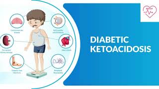 Diabetic Ketoacidosis  Endocrinology lectures  Medicine Neet pg  FMGE  Mrcp [upl. by Netsruk]