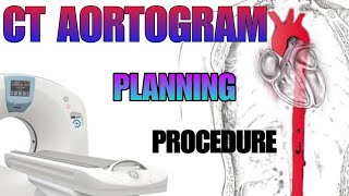 CT AORTOGRAM  planning and procedure explained [upl. by Ky178]