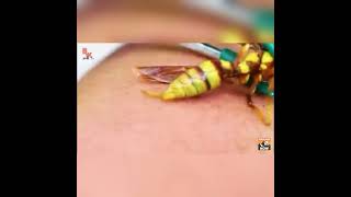 wasp sting  slowmotion video [upl. by Modesta]