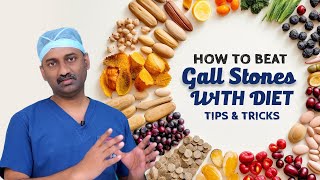 Best Diet tips for Gallstones  Dr Parthasarathy Gallstonestips [upl. by Ditter979]