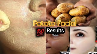 Potato facial at home  Get fair glowing skin  Urgent skin whitening facial at home  Skin Care [upl. by Patt]