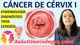 🦀 CÁNCER DE CUELLO DE ÚTERO I 🌍 TIPOS 🩺 DIAGNÓSTICO 🤒 ESTADIAJE  Ginecología y Obstetricia [upl. by Cole]