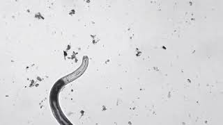 Soil Nematodes [upl. by Eliath]