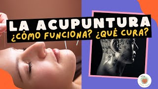 LA ACUPUNTURA Cómo Funciona  Qué cura [upl. by Hendrickson]