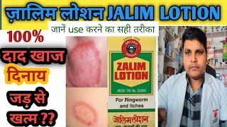 Jalim lotion use dose benifit sideeffectsदाद दिनाय को करे जड़ से खत्म सिर्फ़ ज़ालिम लोशन से [upl. by Filipe776]