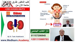 Nephrotic Syndrome cme internalmedicine usmle medical محاضراتباطنة [upl. by Sidwell]