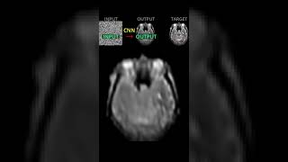 Visual Training of a CNN as a Denoiser Deep Image Prior [upl. by Repmek778]