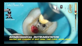 enjoying endodontic treatment using e connect pro endomotor and one curve micromega pop dentistry [upl. by Shurlocke]