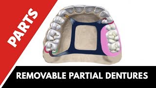 Parts of a cast partial denture  Prosthodontics [upl. by Siubhan976]