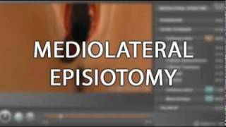 Trailer  Chapter on Episiotomy [upl. by Hickey249]