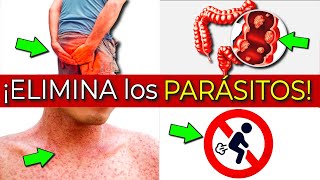 Consecuencias en tu cuerpo de tener parásitos y qué es bueno para eliminarlos [upl. by Hyde]