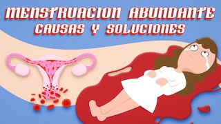 MENSTRUACION ABUNDANTE ¡CAUSAS y SOLUCIÓN por Ginecologa Diana Alvarez [upl. by Adoc]