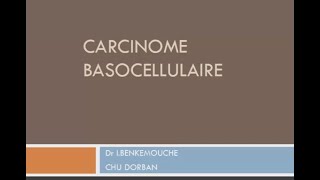 CARCINOME BASOCELLULAIRE  Dr BENKEMOUCHE [upl. by Nnylhsa]