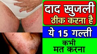 fungal infection in private parts  fungal infection treatment  fungal infection on skin [upl. by Flinn]