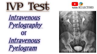 IVP testIntravenous Pyelography IVUIntravenous Urographytest Excretoru Urography test complte [upl. by Napier]